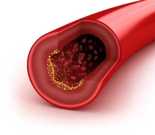 New study finds that "good" cholesterol may not be so great after all