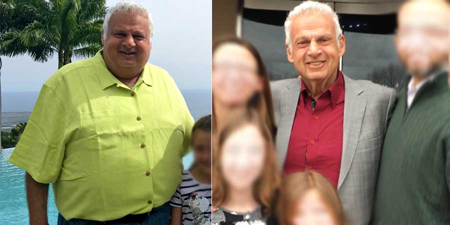 Before & After Photos of Barry's 100 Pound Weight Loss