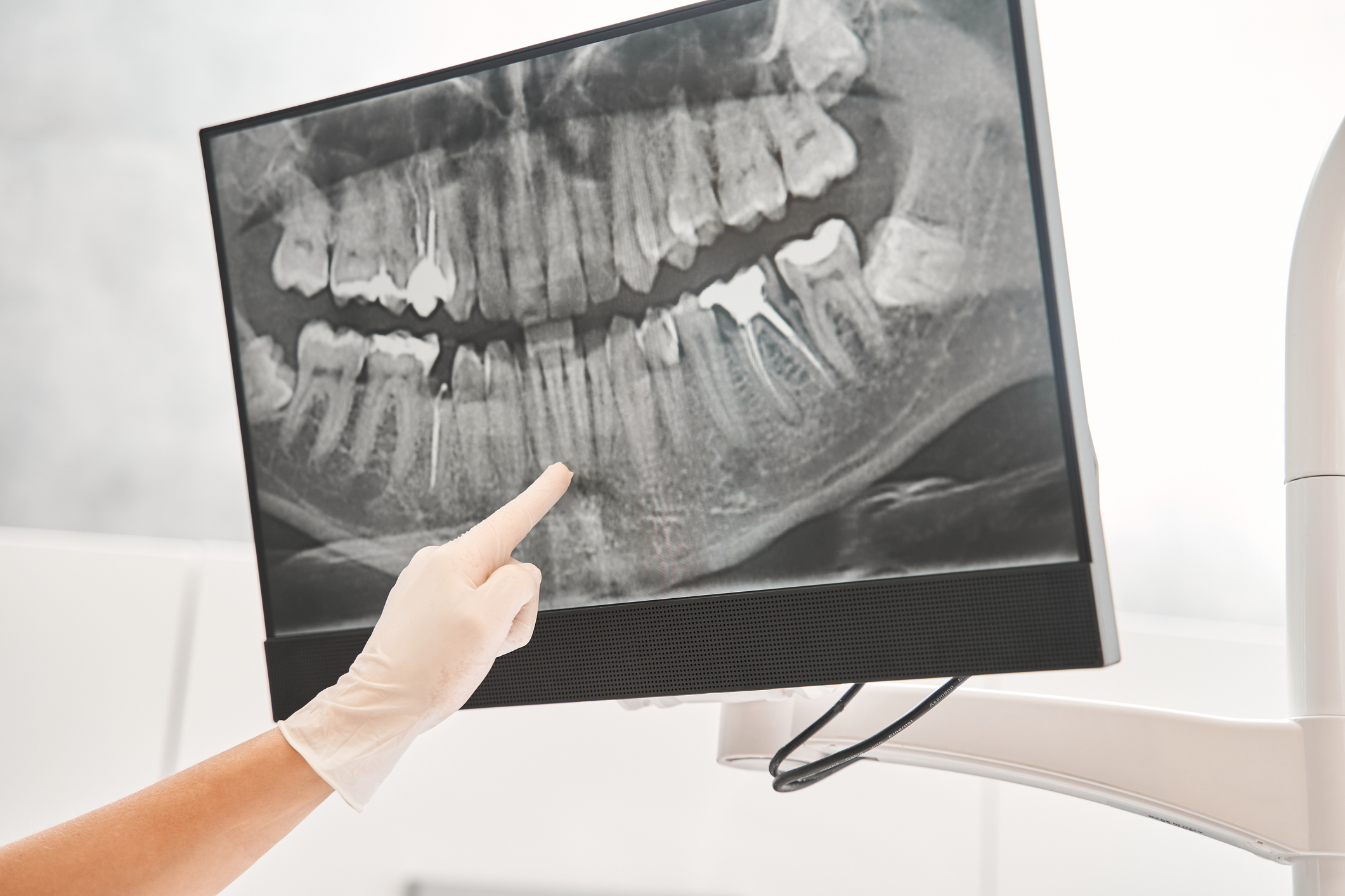 The Importance of Oral Health to the Body