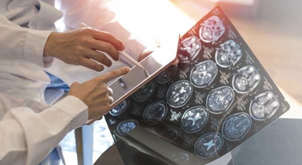 A Heart Healthy Lifestyle Can Prevent Alzheimer’s Disease & Dementia