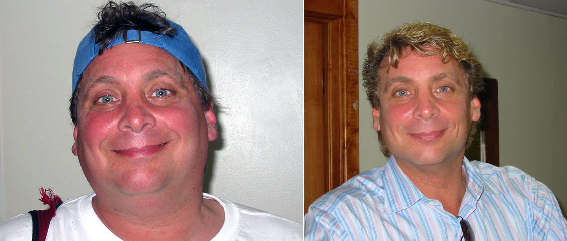 Brad Goldberg Lost 100 Pounds