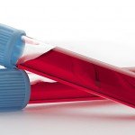 Non-HDL Cholesterol is a measure of your total bad cholesterol.