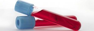 Non-HDL Cholesterol is a measure of your total bad cholesterol.