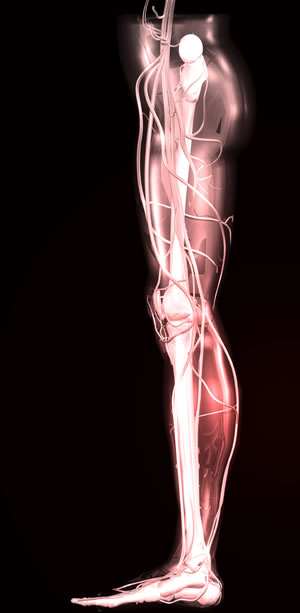 Can bad circulation cause leg pain?