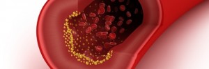 New study finds that "good" cholesterol may not be so great after all