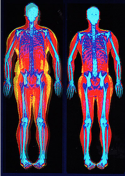 Body Composition Scan at the Pritikin Centeråç