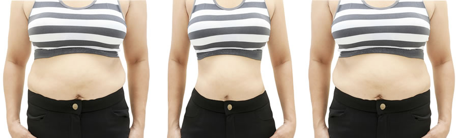 Crash dieting can cause serious damage to your metabolism.