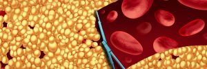The Connection Between Statins and Diabetes