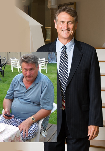 Ron Holley - Before and After